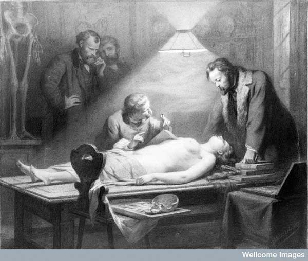 Chalk drawing of woman being dissected by J. H. Hasselhorst