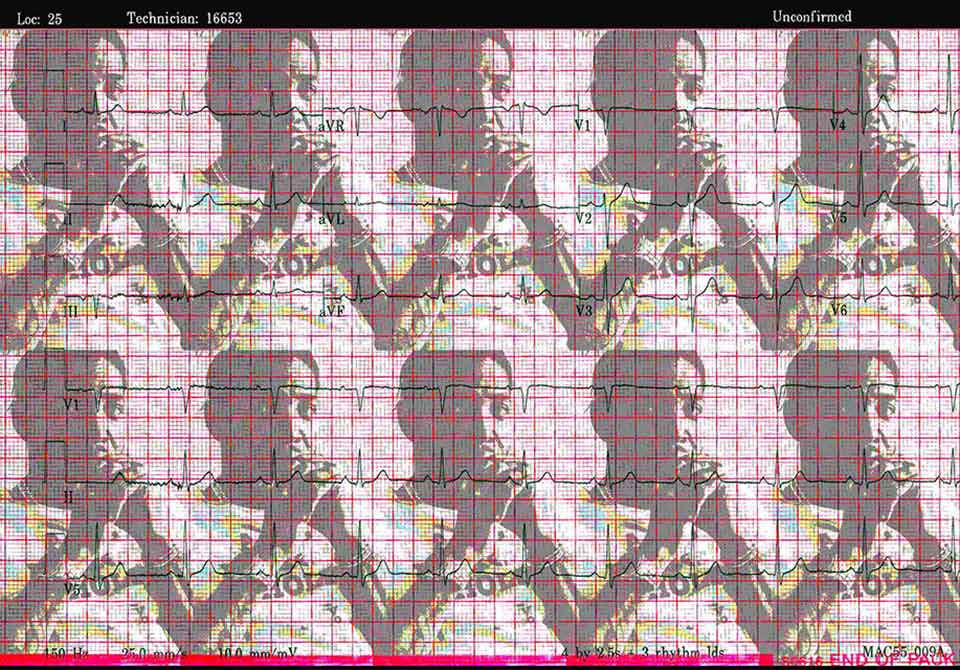 A collage of an EKG read-out superimposed over repeating images of a man