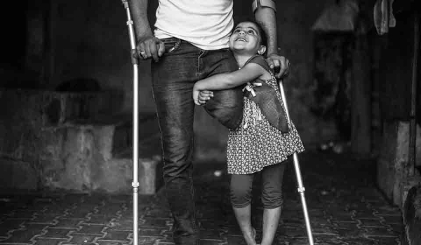 A young girl is holding on to a man who is missing his left leg from the knee down. He is on crutches.